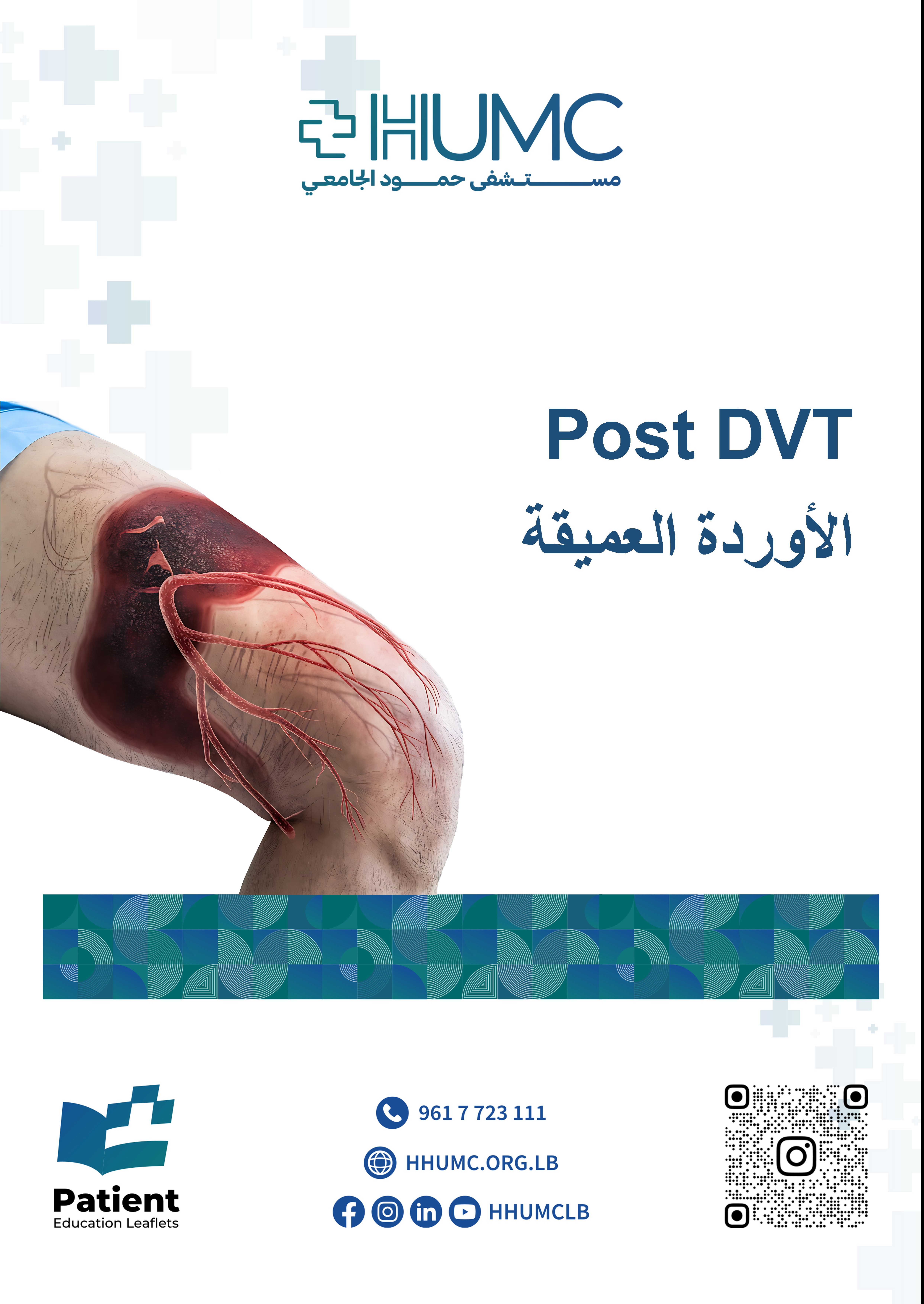 Post DVT